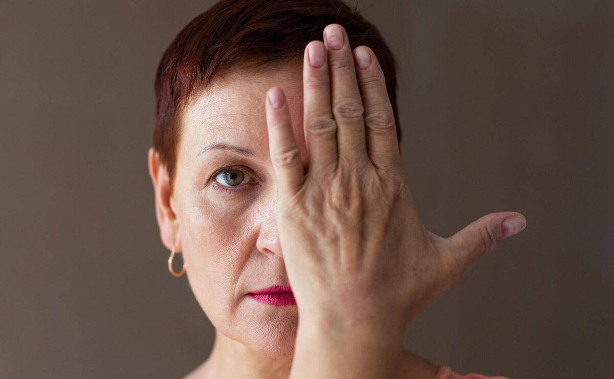 Woman with short hair covering one eye with her hand.