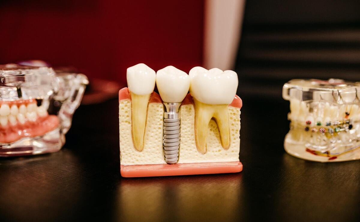 Plastic tooth demonstration set.