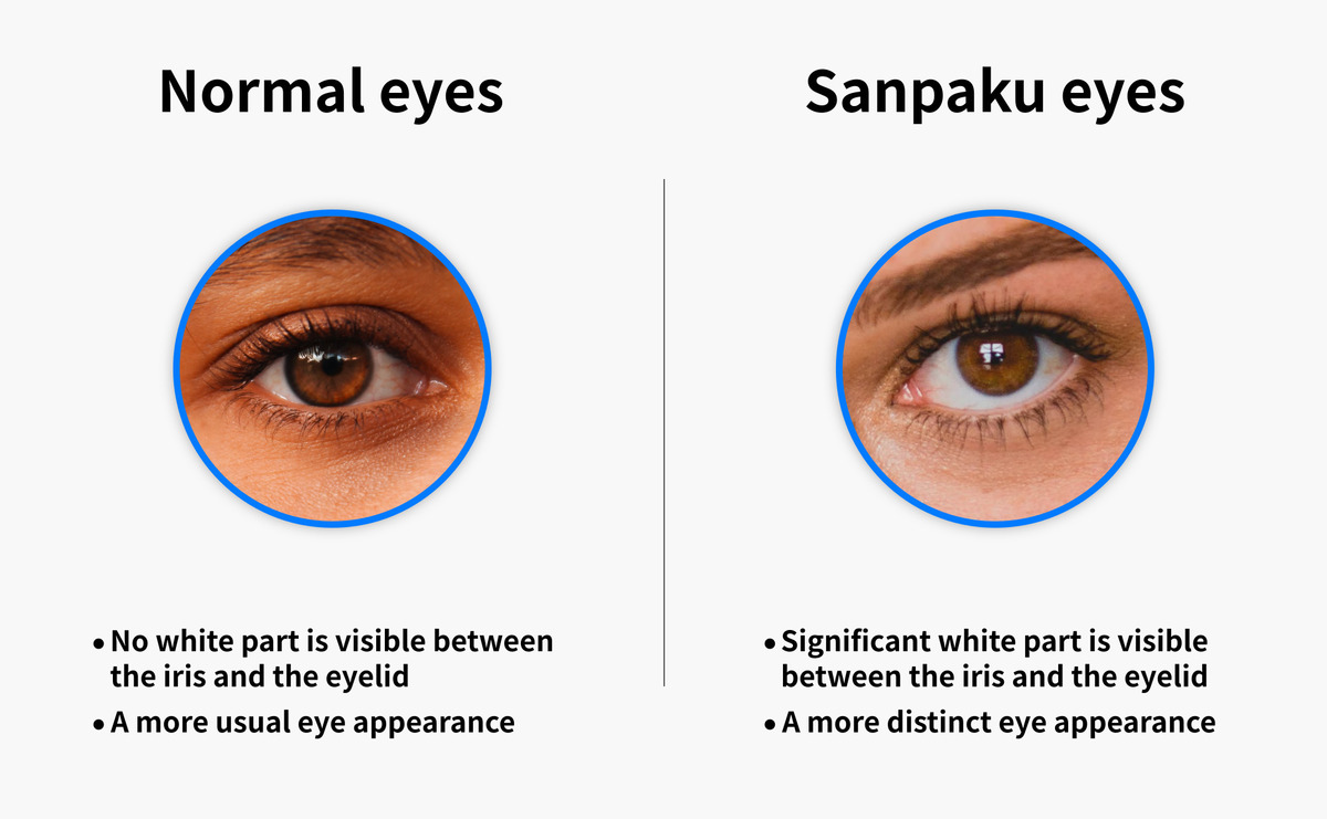 Illustrating the difference between normal and sanpaku eyes.