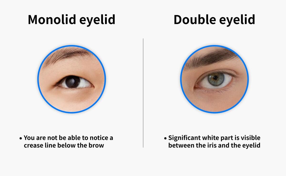 Illustrating the difference between monolid and double eyelids